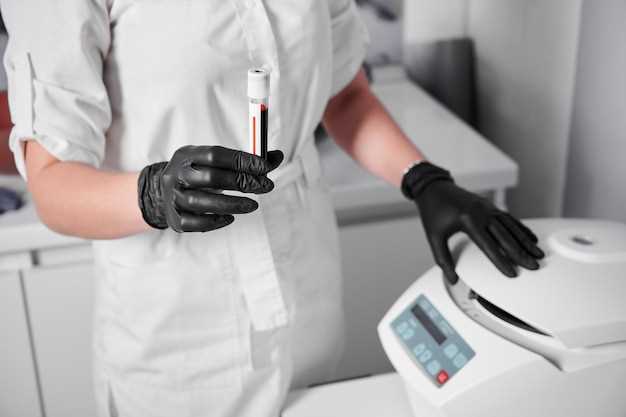 Способы проведения анализа крови на йод