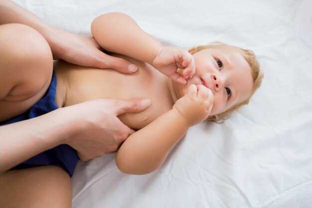 Основные симптомы потницы у младенца