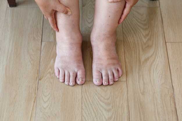 Симптомы и проявления чесотки на ногах