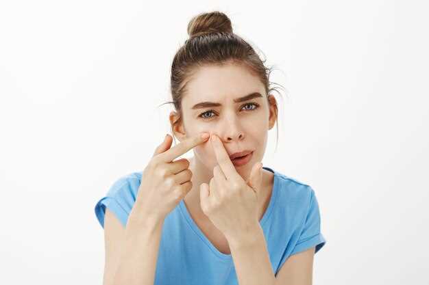 Причины и лечение гнойных выделений из носа