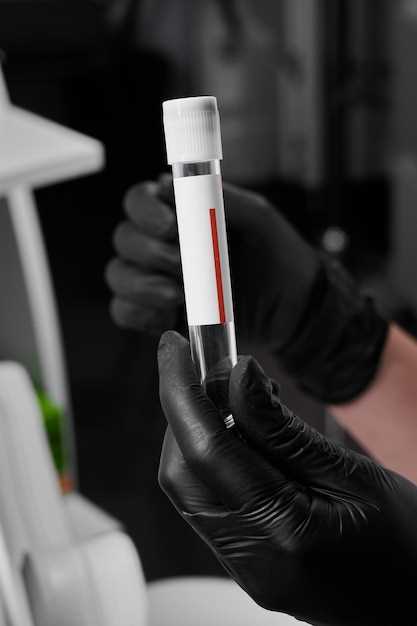 Как интерпретировать результаты общего анализа крови