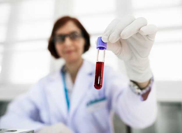 Как долго результаты анализа крови на сифилис сохраняют свою актуальность?