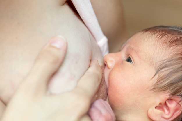Сроки появления желтушки у новорожденных